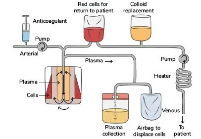 Plasmapheresis